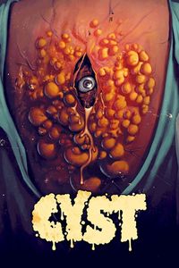 kist